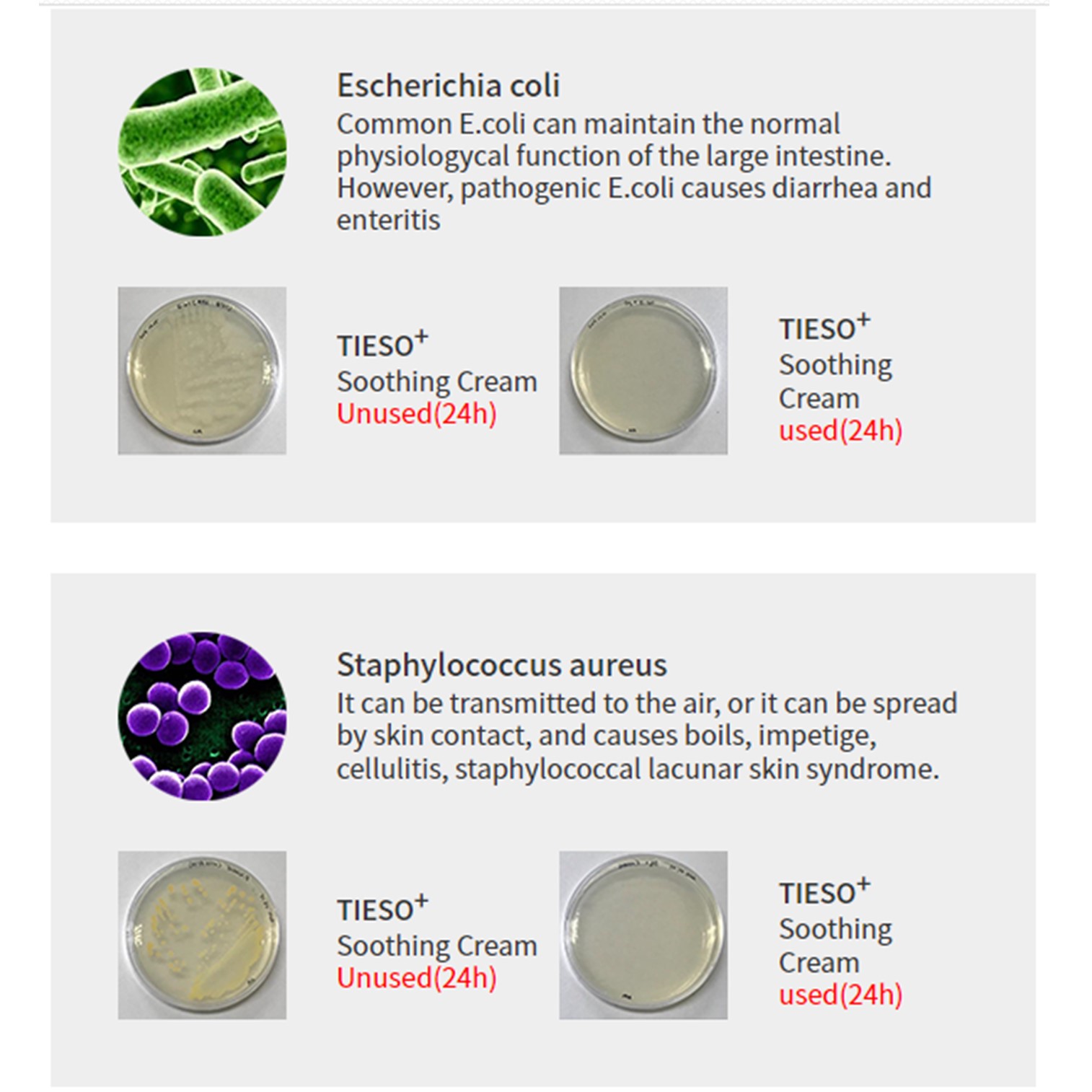 TIESO For Man Male Cleanser 120ml. ผลิตภัณฑ์เจลใสไร้สีไร้กลิ่นสำหรับทำความสะอาดจุดซ่อนเร้นสำหรับผู้ชายจากเกาหลี