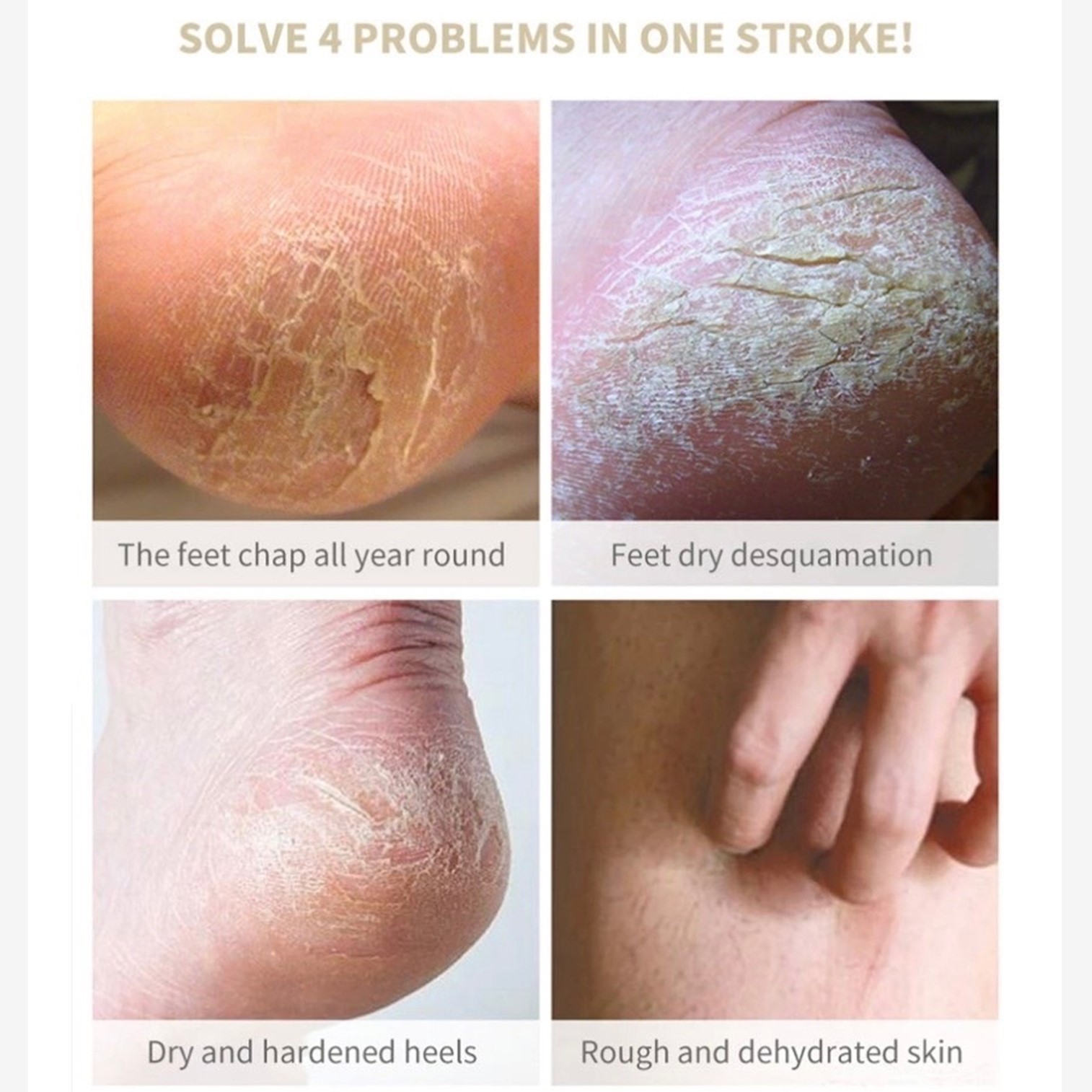 RSNY Foot Skin Care Superior Moisturizing Foot Cream 200ml ผลิตภัณฑ์บำรุงเท้าสูตรพิเศษเพื่อผิวเท้าแลดูสุขภาพดีริ้วรอยจางลงผิวเนียนนุ่มกระชับอ่อนกว่าวัย