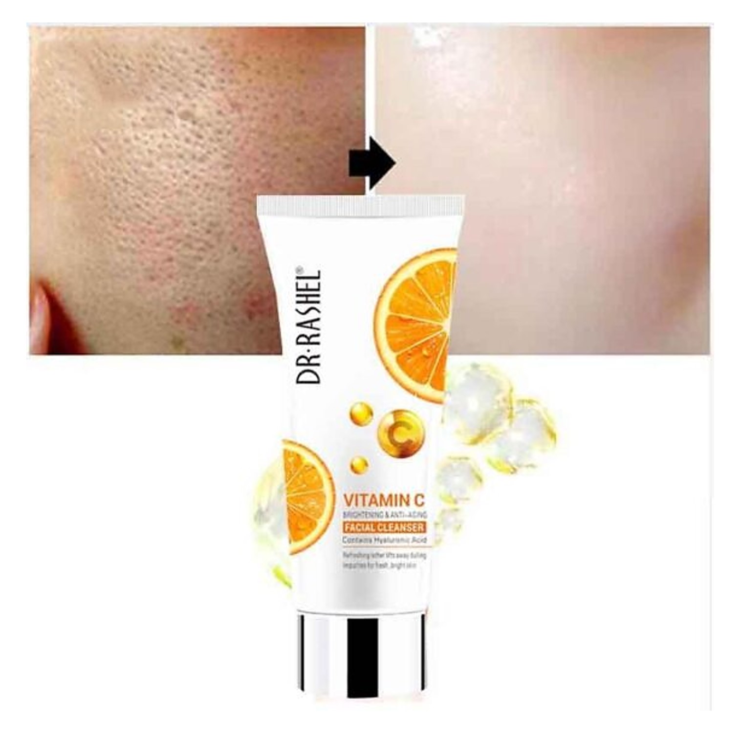 Dr. Rashel Vitamin C Brightening & Anti-Aging Facial Cleanser 80g คลีนเซอร์ทำความสะอาดผิวหน้าสูตรวิตามินซีเพื่อผิวหน้าสะอาดกระจ่างใส