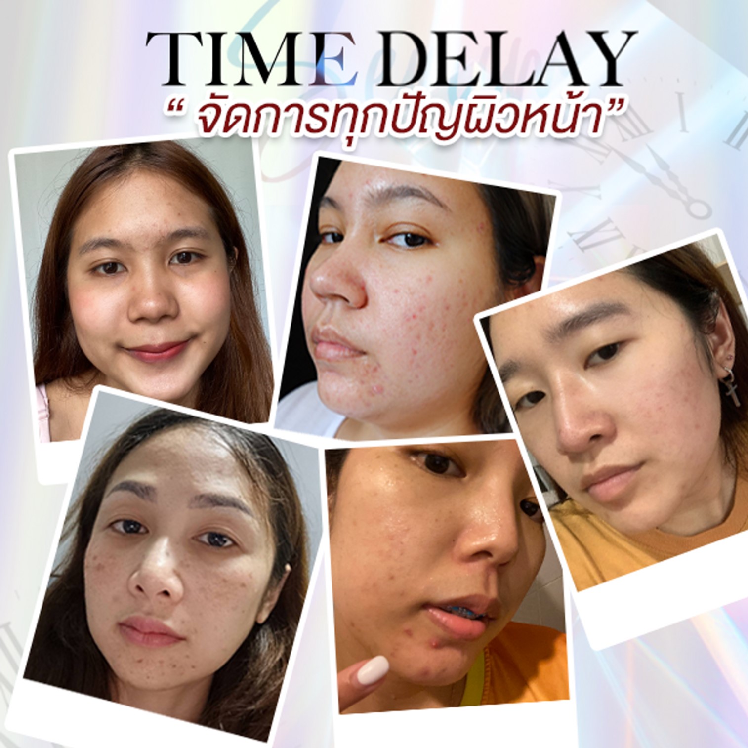TIME DELAY Anti Melasma & Dark Spot Serum 30ml เซรั่มบำรุงผิวหน้าสูตรลดปัญหาฝ้ากระจุดด่างดำหมองคล้ำได้ตรงจุด