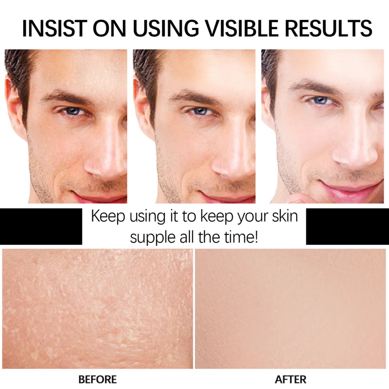 E’YEARN For Men Hyaluronic Acid Moisturizing Cream 50g ครีมมอยซ์เจอร์ไรเซอร์เข้มข้นบำรุงผิวหน้าสำหรับผู้ชาย