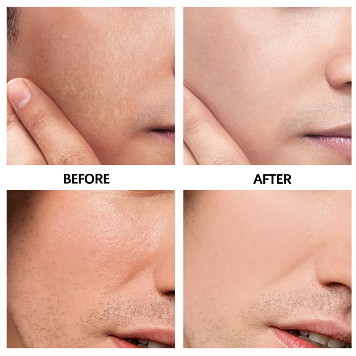 E’YEARN For Men Hyaluronic Acid Moisturizing Cream 50g ครีมมอยซ์เจอร์ไรเซอร์เข้มข้นบำรุงผิวหน้าสำหรับผู้ชาย