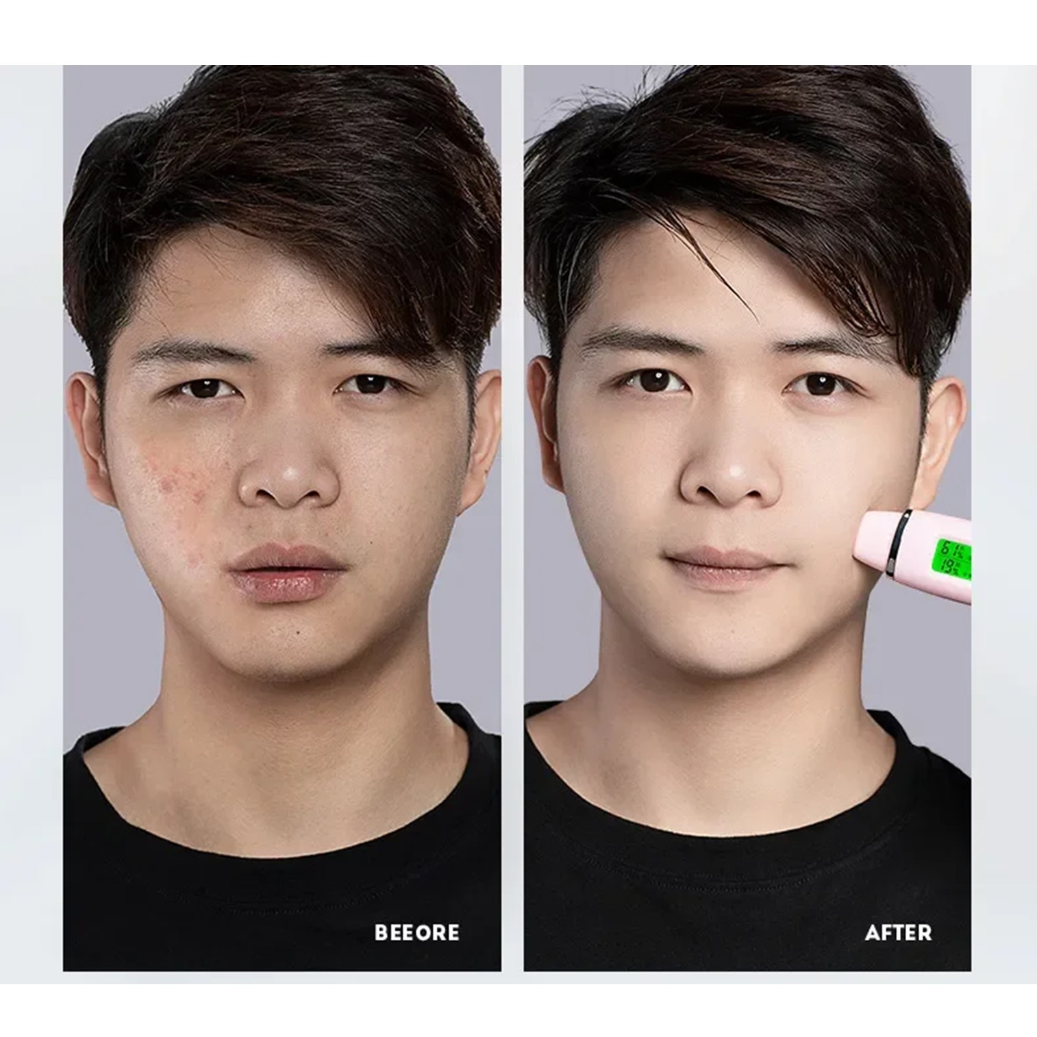 JVR Powerful Clarity Smooth Clear Cleanser 100ml ผลิตภัณฑ์ทำความสะอาดผิวหน้าผู้ชายสูตรพิเศษเพื่อผิวสะอาดเนียนใสสดชื่นแลดูอ่อนกว่าวัย