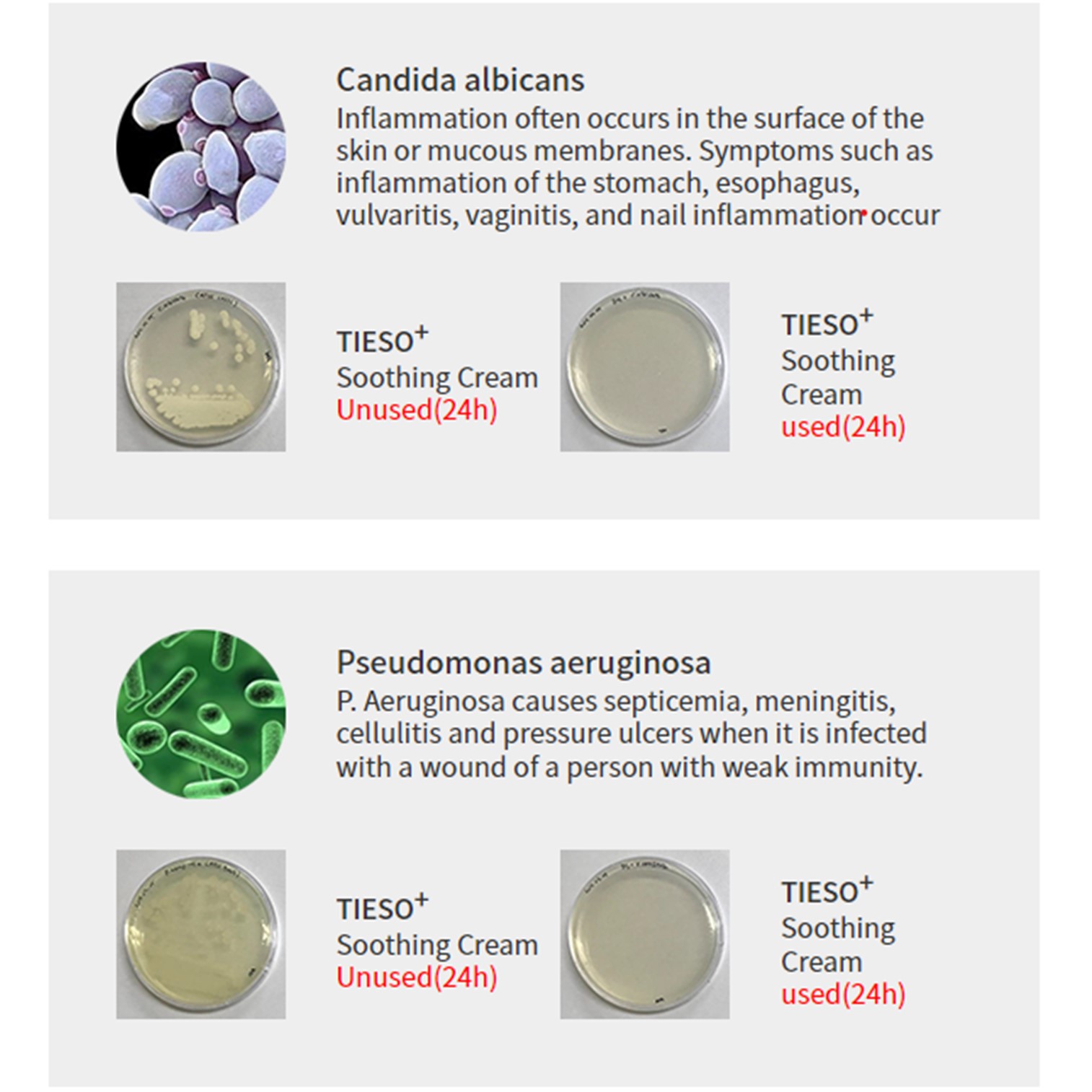 TIESO For Man Male Cleanser 120ml. ผลิตภัณฑ์เจลใสไร้สีไร้กลิ่นสำหรับทำความสะอาดจุดซ่อนเร้นสำหรับผู้ชายจากเกาหลี