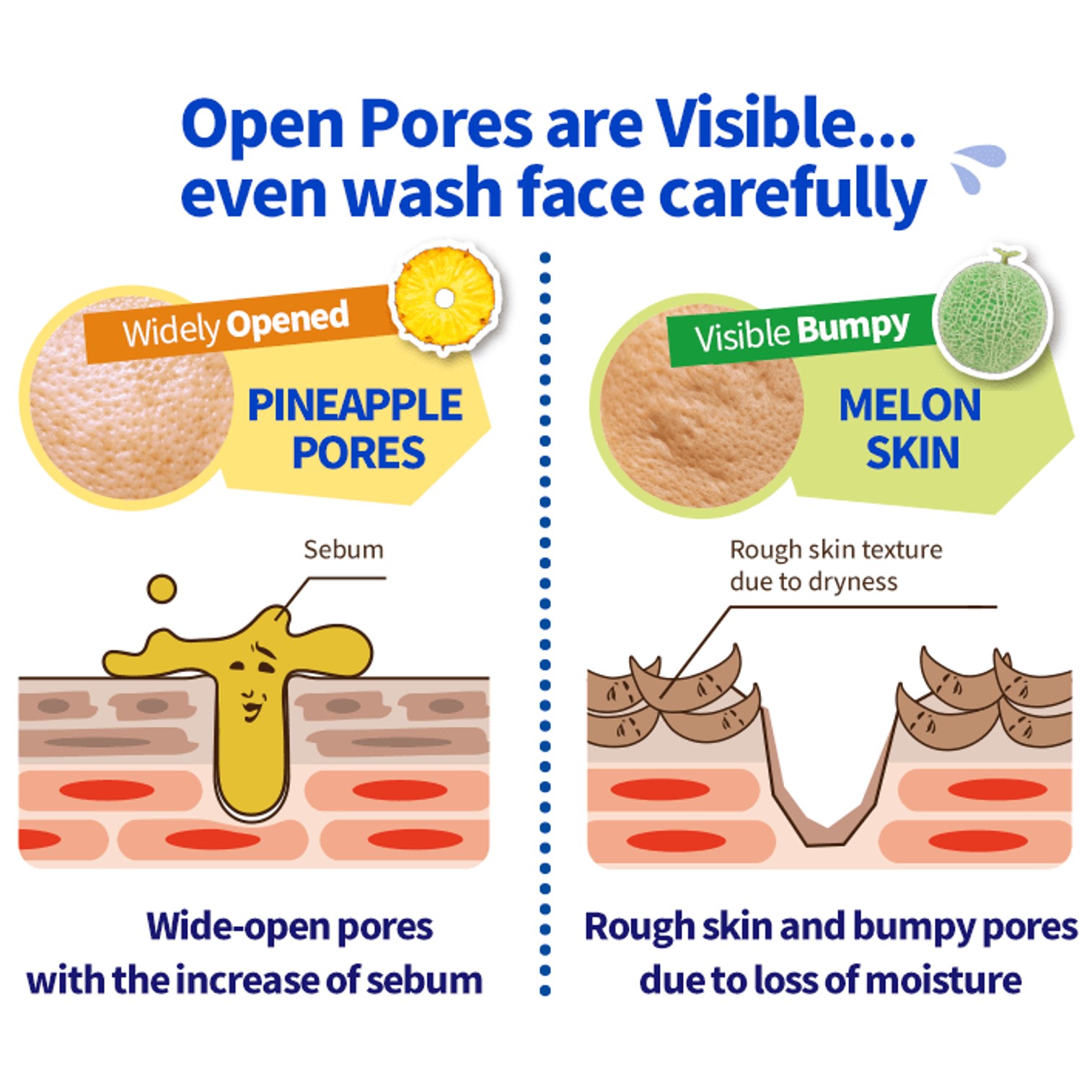 KEANA PORE TIGHTENING LOTION FOR MEN 300ml ผลิตภัณฑ์โลชั่นบำรุงผิวหน้าผู้ชายจากญี่ปุ่นของแท้