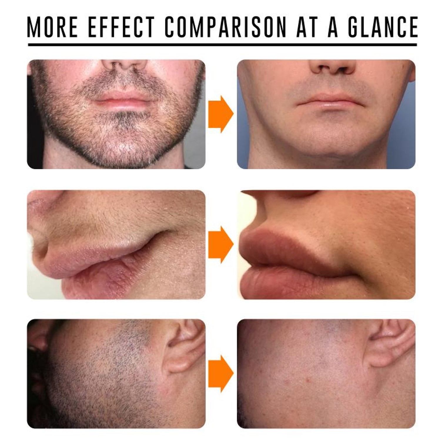 EELHOE Moustache Hair Remover 50g ครีมกำจัดหนวดและขนสูตรอ่อนโยนสำหรับผิวหน้า