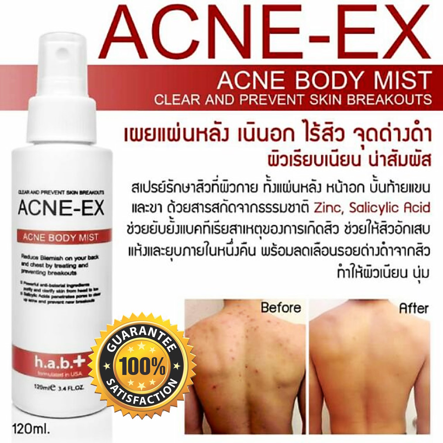 ACNE-EX Acne Body Mist 120ml. สเปรย์ลดการอักเสบของสิวและรอยสิวบริเวณร่างกาย