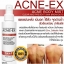 ACNE-EX Acne Body Mist 120ml. สเปรย์ลดการอักเสบของสิวและรอยสิวบริเวณร่างกาย